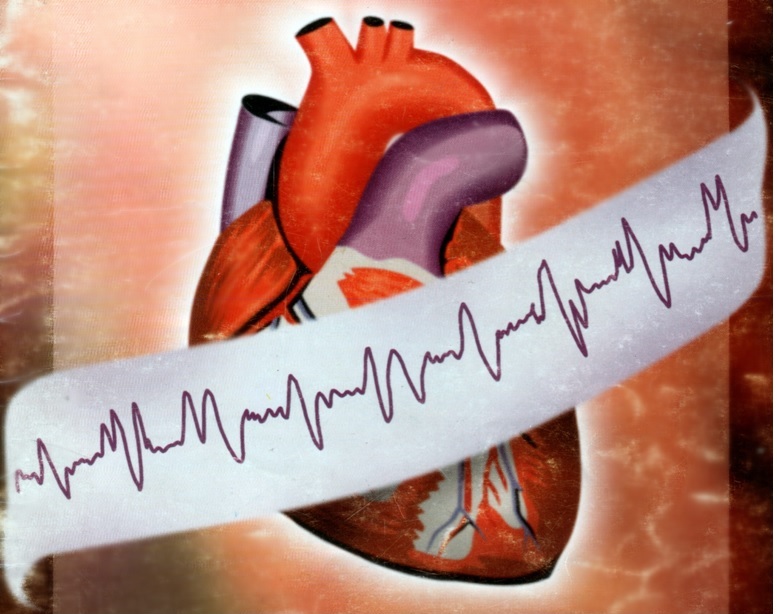 ������� �������������